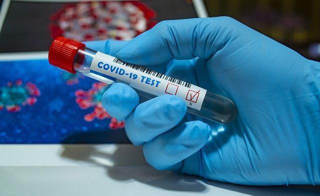 В Пермском крае у сотрудника минздрава выявили коронавирус