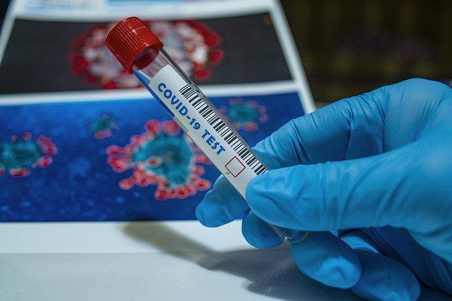 В Пермском крае за сутки выявили 68 случаев коронавируса