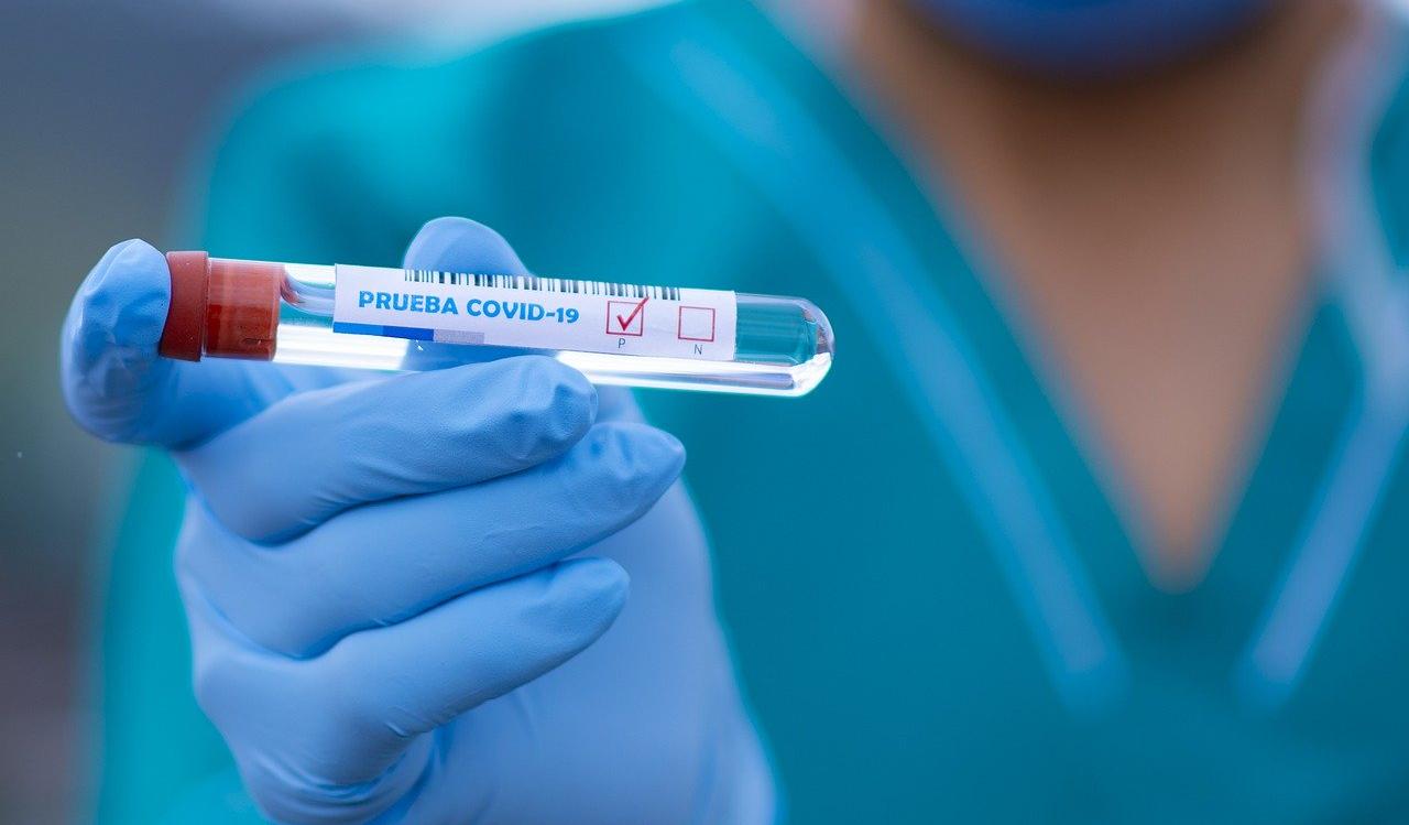В Пермском крае за сутки выявили 109 новых случаев коронавируса