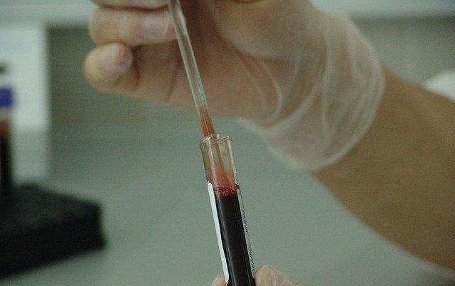 В Прикамье стало больше заболевших ВИЧ-инфекцией