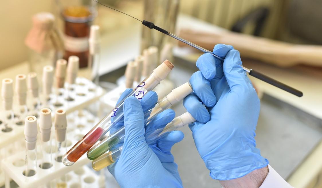 В Прикамье выявили еще 51 случай заражения коронавирусом