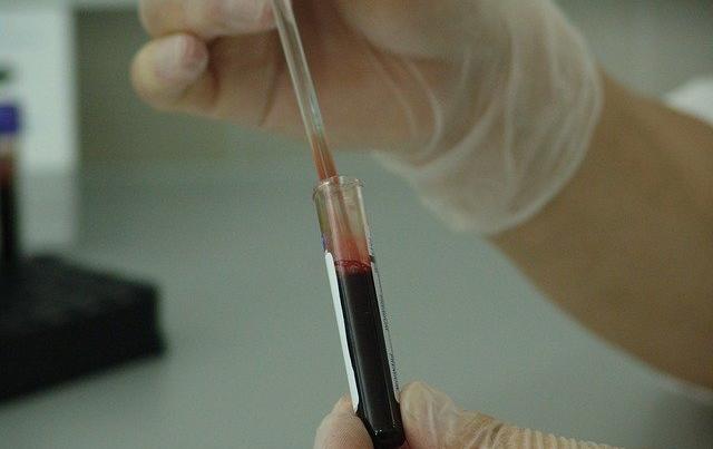 В Пермском крае с начала года на 6,6% снизилась заболеваемость ВИЧ-инфекцией