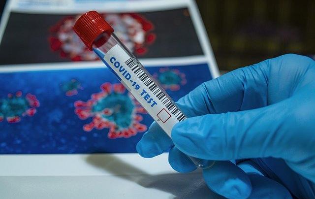 В Пермском крае за сутки выявили 74 случая коронавируса